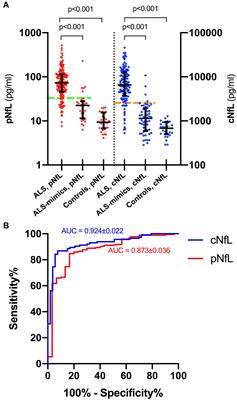 Plasma and CSF Neurofilament Light Chain in Amyotrophic Lateral Sclerosis: A Cross-Sectional and Longitudinal Study